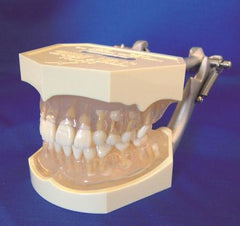 Child Dental Model Anatomically Shaped Teeth Age 8-9