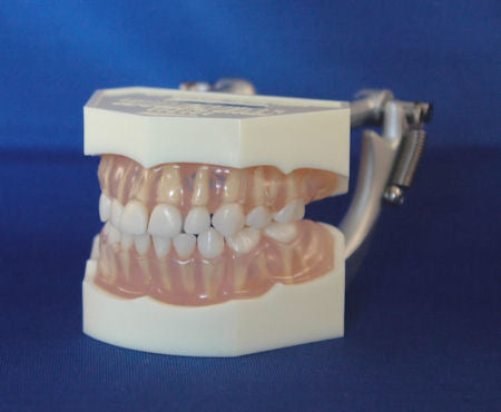 primary dentition dental model