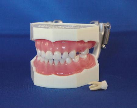 Primary Dentition Typodont Soft Pink Silicone Gingivae Model