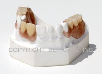 Flex Partial Dental Model 28 Teeth