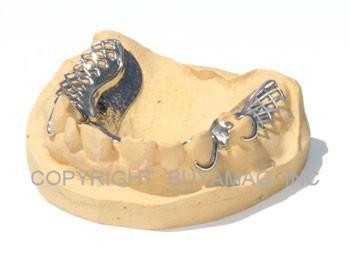 Metal Frame Work Dental Model With Material 14 Teeth