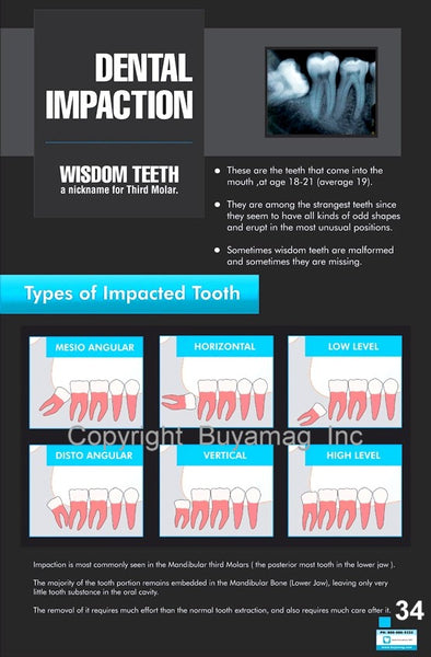 Dental Poster Dental Impaction Office Patient Education