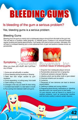 Dental Poster Bleeding Gum Office Patient Education