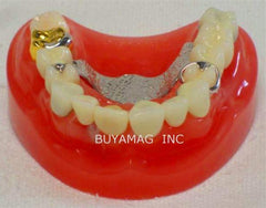 Dental Implants & Crown & Bridge Combination 9 parts Model