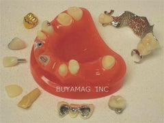 Dental Implants model Crown & Bridge Combination 9 parts 