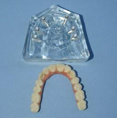 6 implants denture bridge model