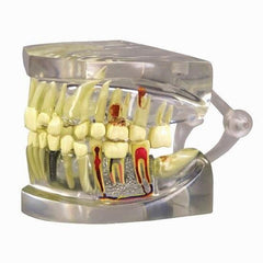 dental pathologies model