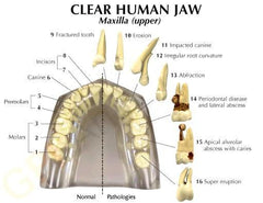 teeth pathology disease model