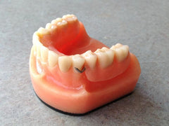 dental Partial models