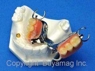 Dental Partial Model With Framework Locator Termoflex Clasp