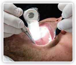 Dental Oral Cavity Led Light System