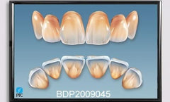 dental charts