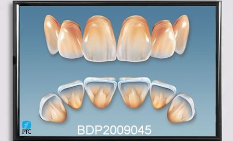 Dental Poster Anterior Teeth Anatomy