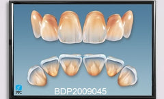 Dental Poster Anterior Teeth Anatomy
