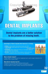 Dental Implants Poster
