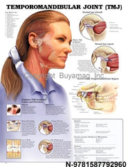 Temporomandibular Joint TJM Poster