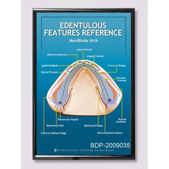 Dental Poster Mandibular Arch Edentulous Features Reference