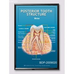 Posterior Tooth Molar Structure Poster