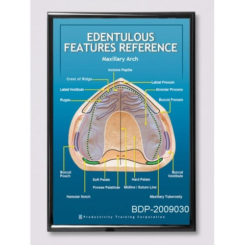 Edentulous Features Reference Maxillary Arch Poster