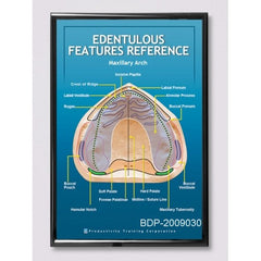 Edentulous Features Reference Maxillary Arch Poster