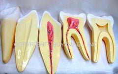 Dental Teeth Molar & Incisor Anatomy 2 Set Giant 12 Times Enlarged Dental Teeth 2 Set