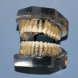Dental Model Upper & Lower Jaws 32 Teeth
