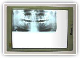 dental x-ray film viewer box