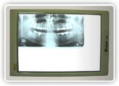 dental x-ray film viewer box