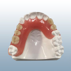 dental flexible partial model