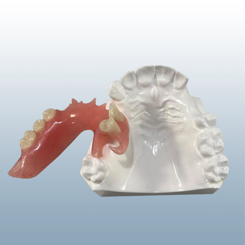 dental flexible partial model