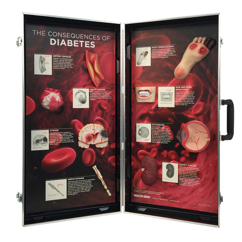 dabetes disease model display