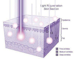 LED Technologies Rejuvenating Infrared Light DPL Two Panel Therapy System