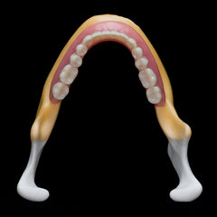 Edentulous Mandible With Partial