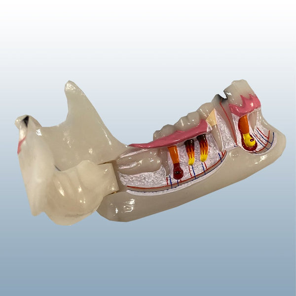Endodontic pathological model