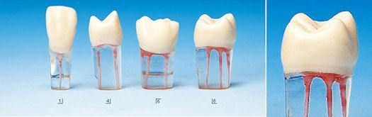 Endodontic Teeth & Transparent Root