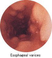 endoscopy upper gi examination