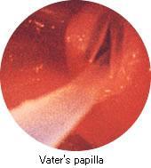 Endoscopy Exam manikin Gastrointestinal Simulator