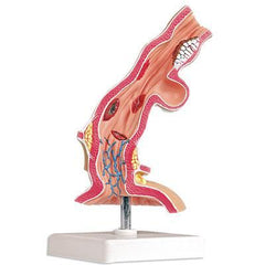 Esophagus Pathological Disease Model