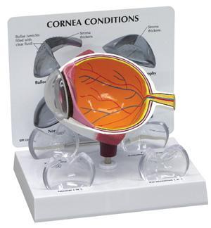 Cornea Eye Cross Section Model