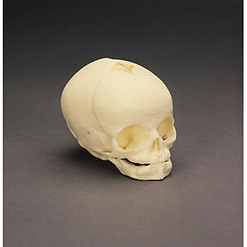 Fetal Skull