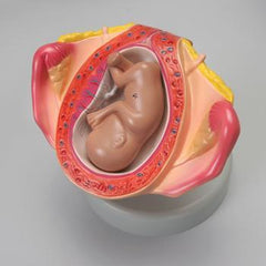  Uterus fetus Model