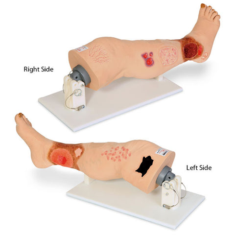foot wound gangrene model