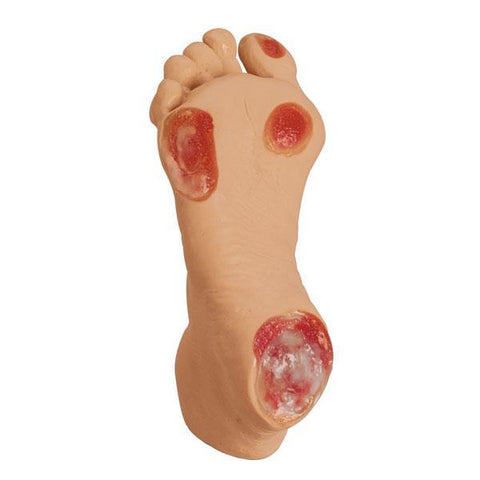 Pressure Ulcer Foot Model Simulator