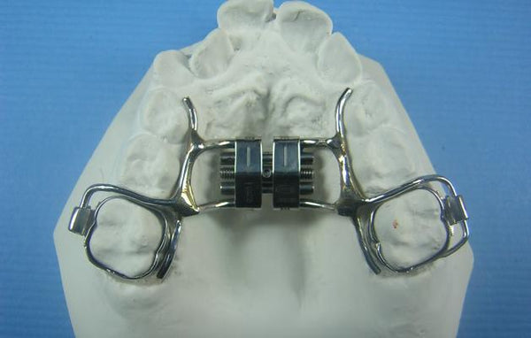 Freedom-Lock System Retainer Orthodontic Model