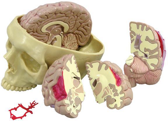 brain anatomical model