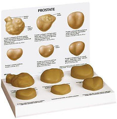 Prostate Pathologies Model