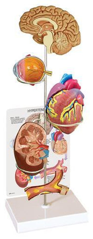 Hypertension Model Set of 5 Models In One