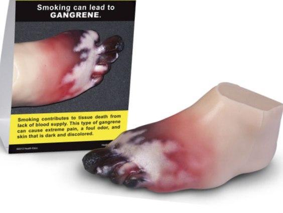 smokers foot gangrene model