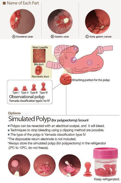 Optional  15 Polyps