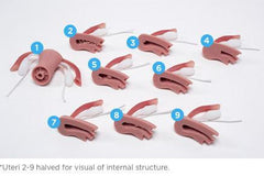 Optional Internal Uteri Normal Abnormal